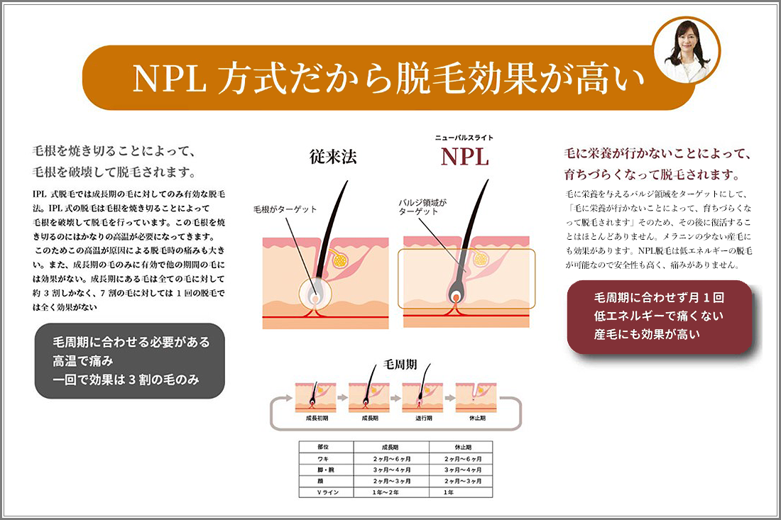 脱毛の特徴