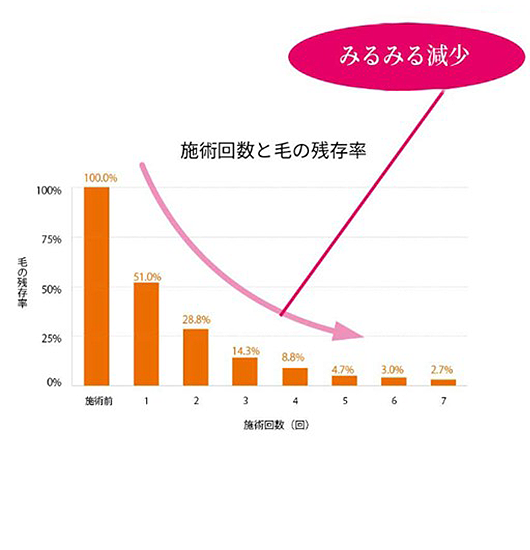 脱毛の特徴01（グラフ）