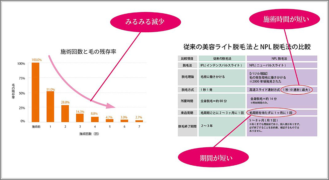 脱毛の特徴（グラフ）