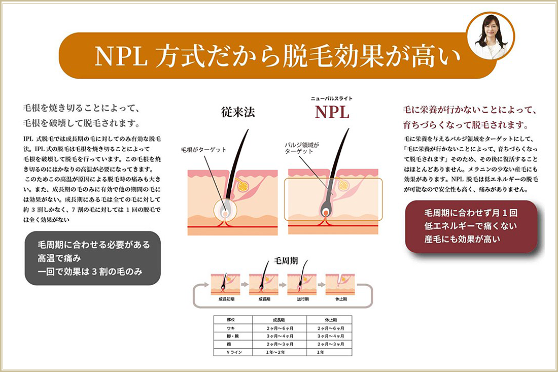 脱毛の特徴